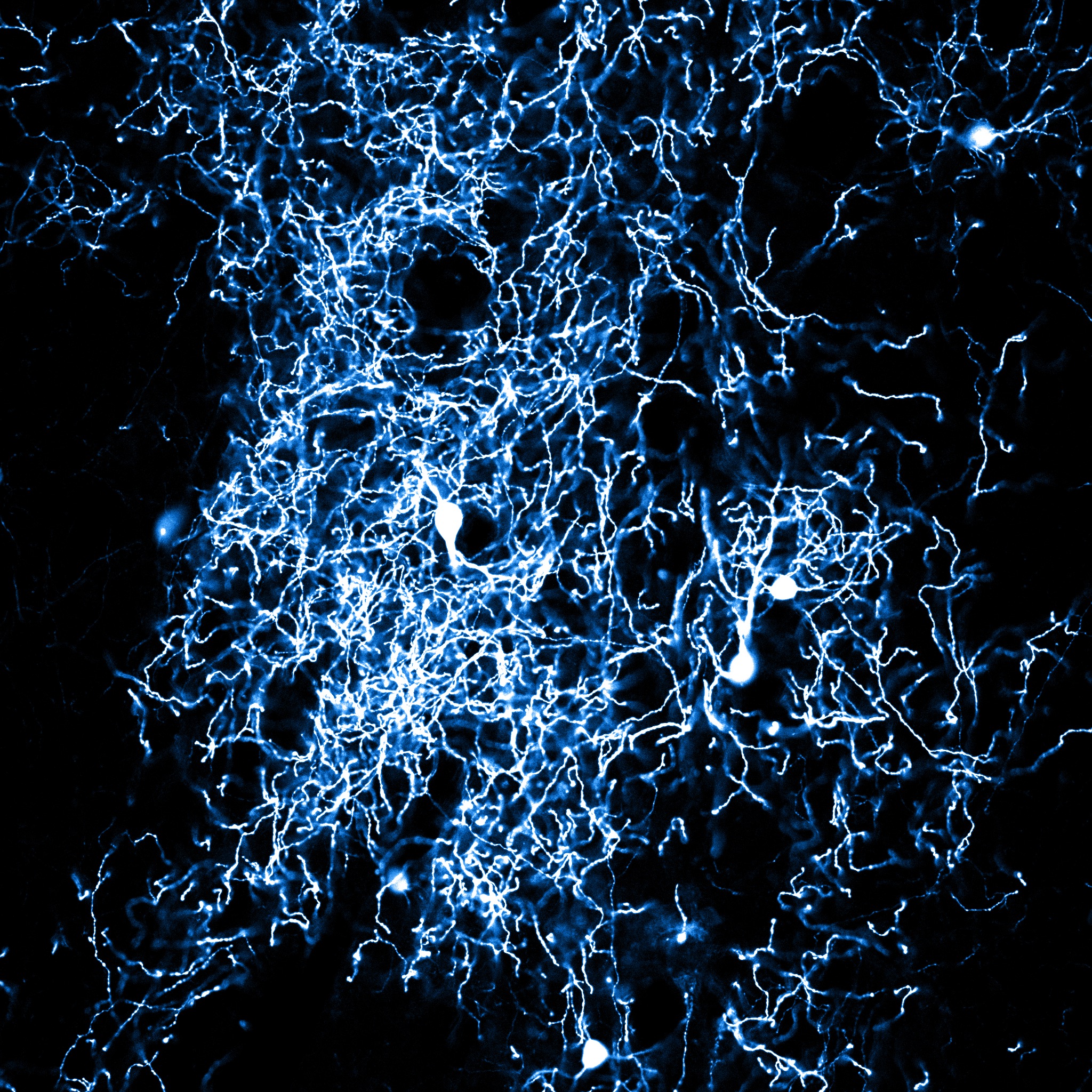 Nexus – installation detail